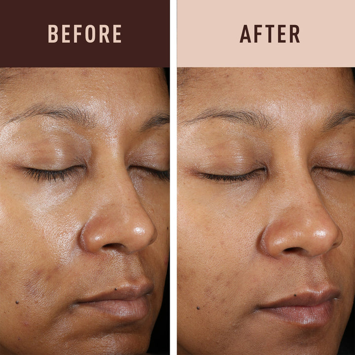 Even & Clear Fade Cream Hydroquinone-Free